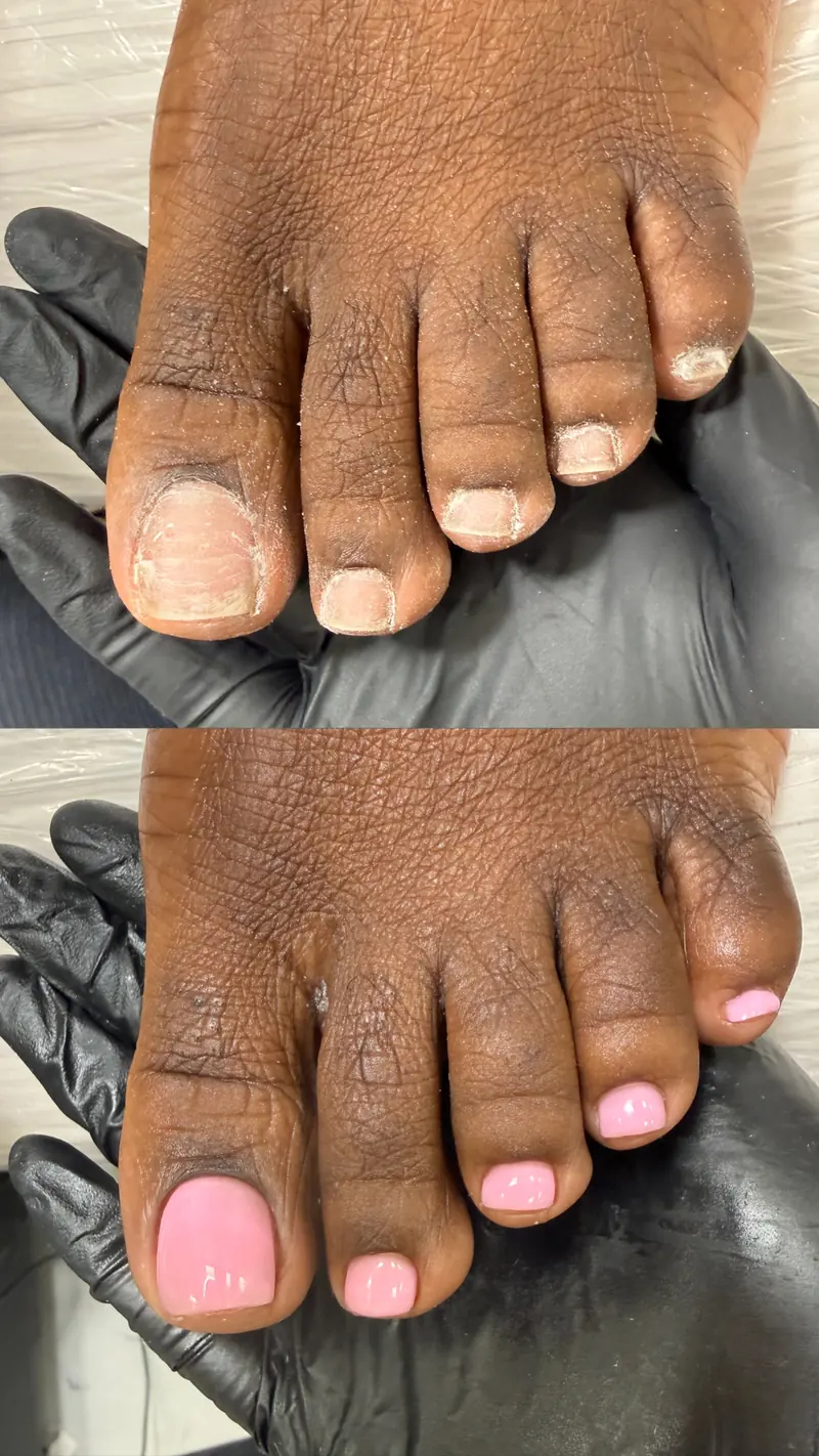 Before and after gel pedicure result in Manhattan