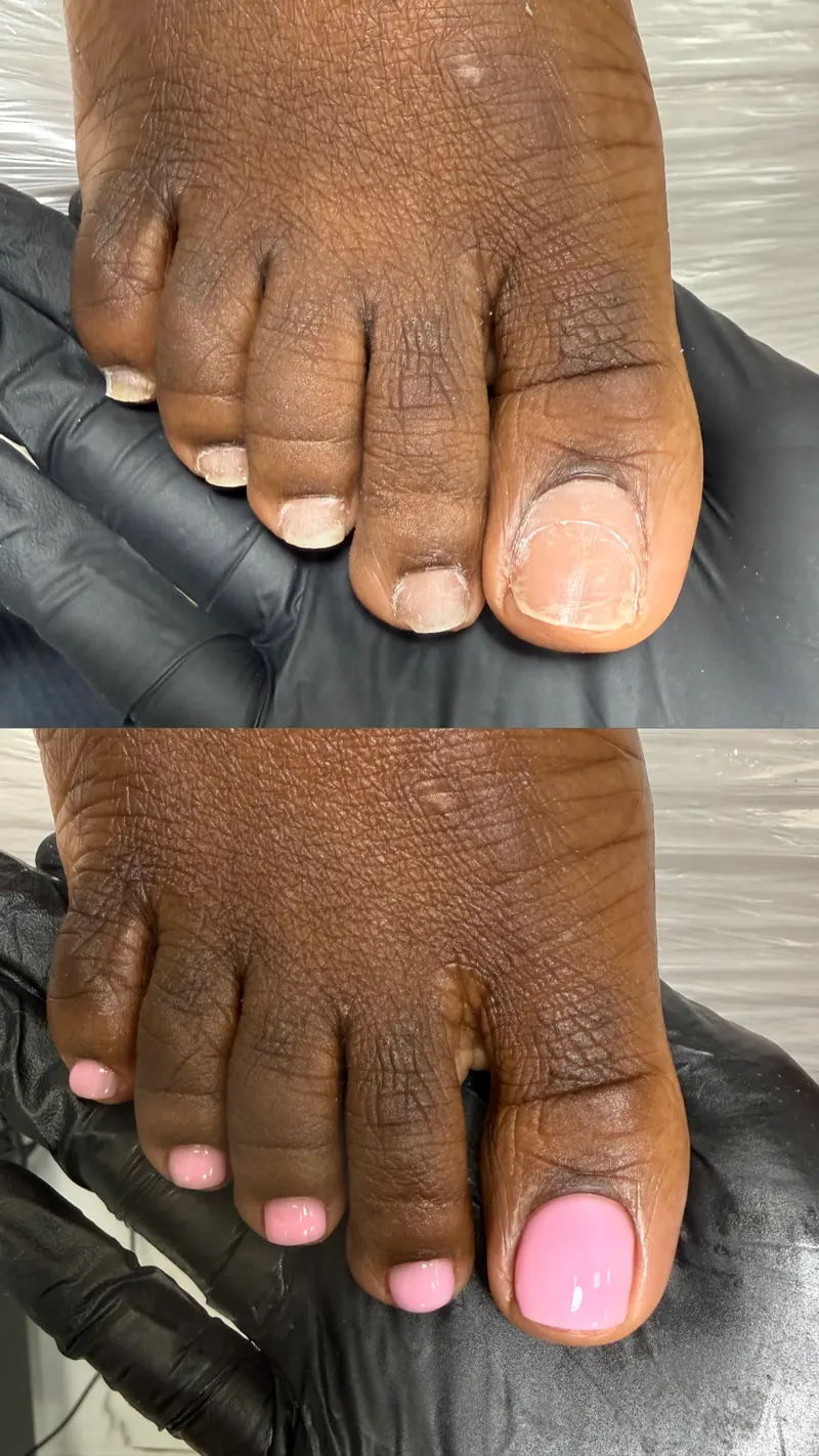 Before and after gel pedicure result in NYC