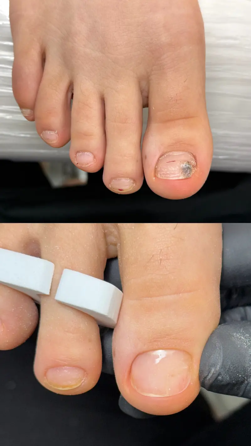 Before and after pedicure result in Manhattan