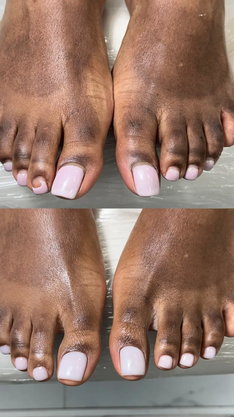 Before and after pedicure result in NYC