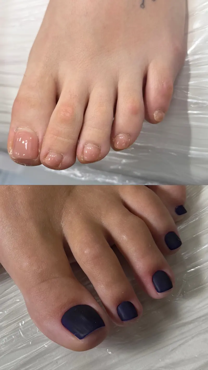 Before and after SMART gel pedicure result in Manhattan