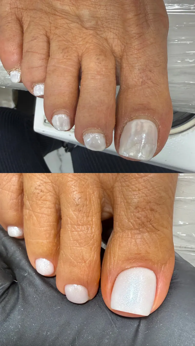 Before and after SMART Pedicure result in NoMad