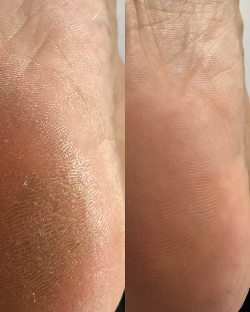 No-polish SMART Pedicure result with natural clean toenails in NoMad, Manhattan