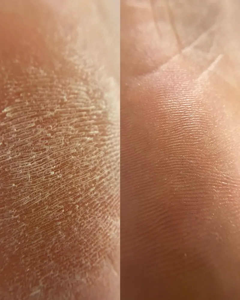 Heel-care SMART Pedicure result at Darlings Beauty Lab in NYC