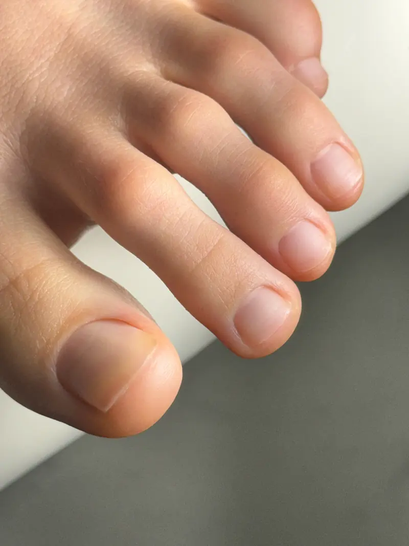 Pedicure close-up with neat toenails and clean finish in Manhattan